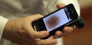 Smartphone softver za rak koze