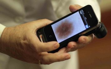 Smartfoni će imati softver koji može prepoznati rak kože Smartphone softver za rak koze