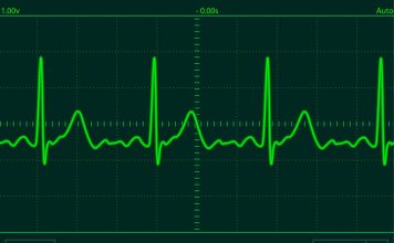 I otkucaji srca bi mogli biti ”password” otkucaji srca bi mogli biti ''password''