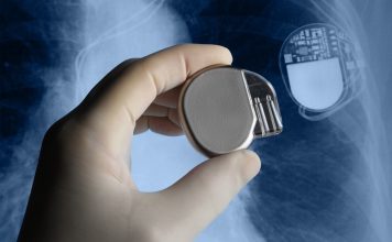 hakovanje pejsmejkera