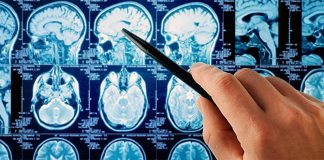Izazivaju li elektromagnetska polja tumore kod ljudi