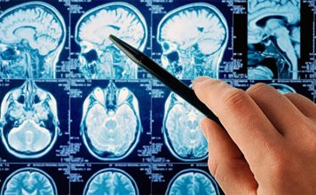 Izazivaju li elektromagnetska polja tumore kod ljudi